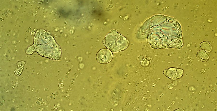 Microscope image US001 Microscope image